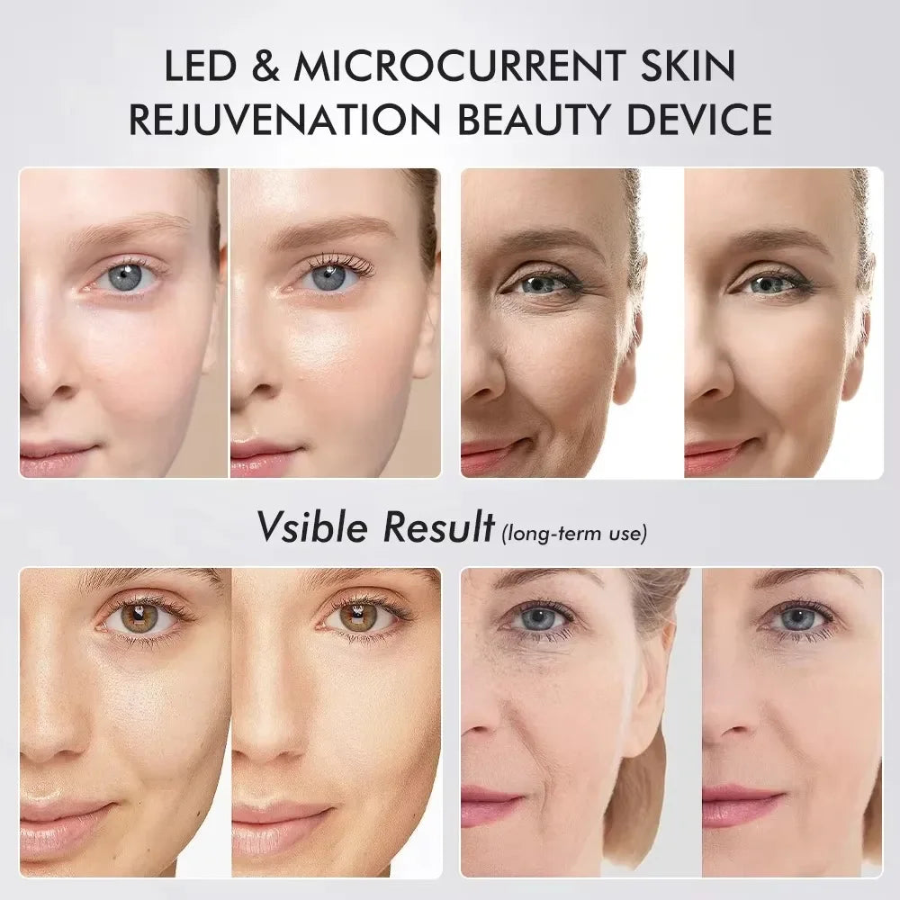 Skincare Anti-aging beauty device